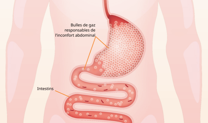 Illustration montrant l'élimination des gaz