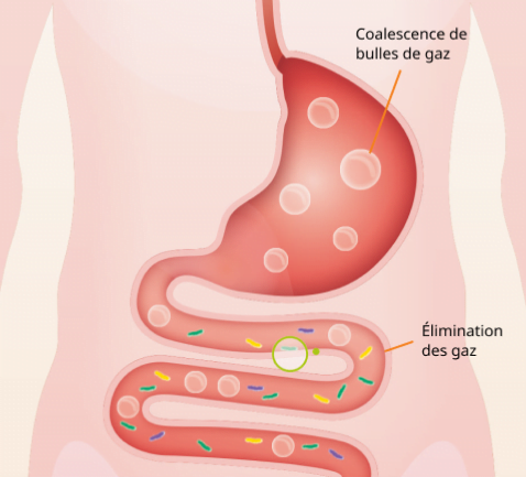 Illustration montrant des bulles de gaz responsable de l'inconfort abdominal