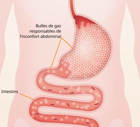Illustration montrant l'élimination des gaz